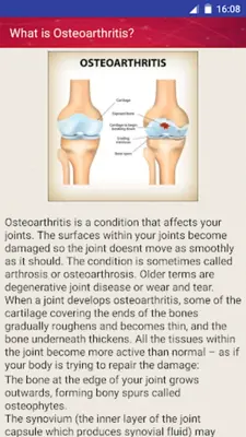 Osteoarthritis Help and Home Remedies android App screenshot 14