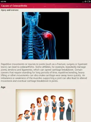 Osteoarthritis Help and Home Remedies android App screenshot 5